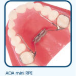 palatal expander model