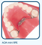 palatal expander